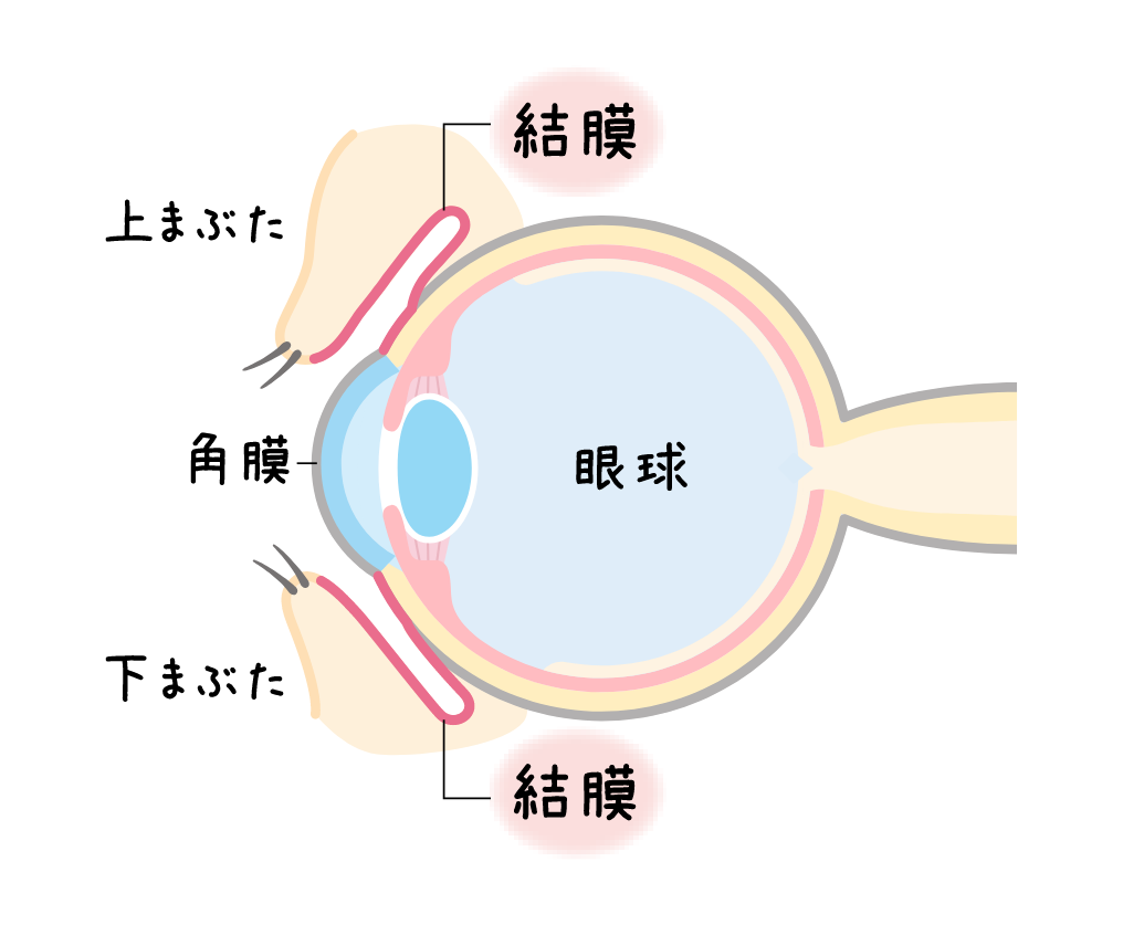 結膜の位置表すイラスト。目の周囲の断面図。上まぶた・下まぶたそれぞれの内側に結膜がある。結膜の内側には眼球があり、眼球の表面には角膜がある。