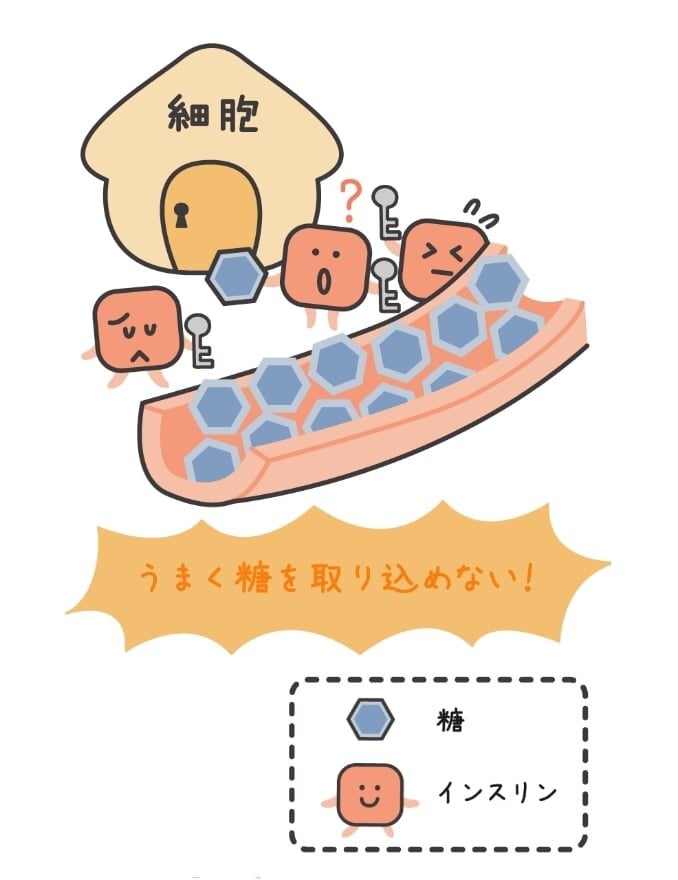 インスリン抵抗性の説明図。「細胞」と書かれた家に鍵のついたドアがあり、インスリンのキャラクターたちが手に鍵を持っている。インスリンたちは働きが鈍くなっているためカギでドアをうまく開けられず困っている。血管に細胞内に入れなくなった糖が溢れている。「うまく糖を取り込めない！」