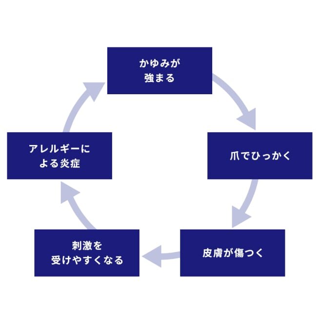 かゆみと炎症の悪循環を表した図。かゆみが強まる→爪でひっかく→皮膚が傷つく→刺激を受けやすくなる→アレルギーによる炎症→かゆみが強まる…と悪循環が起きている。