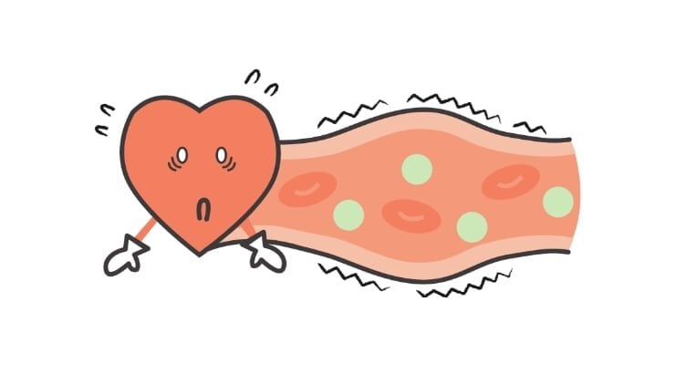 塩分を摂りすぎている状態の血管イメージ②の図。血管に流れる血液などの量が増え、内側からの圧力が強くなり、血管の先にある心臓に負担がかかっている。