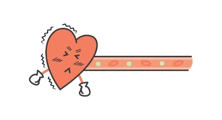 加齢やストレス、睡眠不足の影響を受けている状態の血管イメージ図。細く・弾力性の低下した血管の先にある心臓に負担がかかっている。