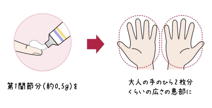 1FTUのイメージ図。チューブから薬を人差し指に出しているイラスト。「第1関節分約(0.5g)を」。大人の両手のひらのイラスト。「大人の手のひら2枚分くらいの広さの患部に」